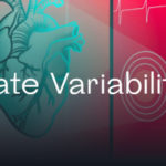 The Cost of Running an Online Casino